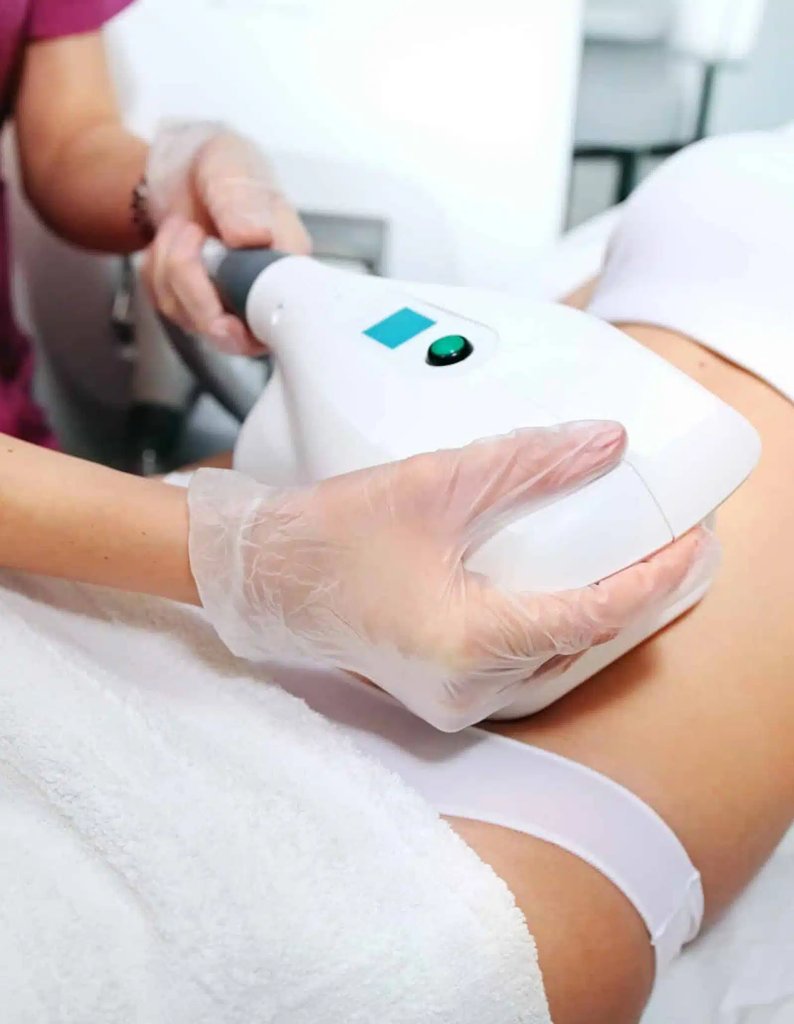Evolve Trim in Orlando at Wymore Laser Dermal Fillers Winter Park FL