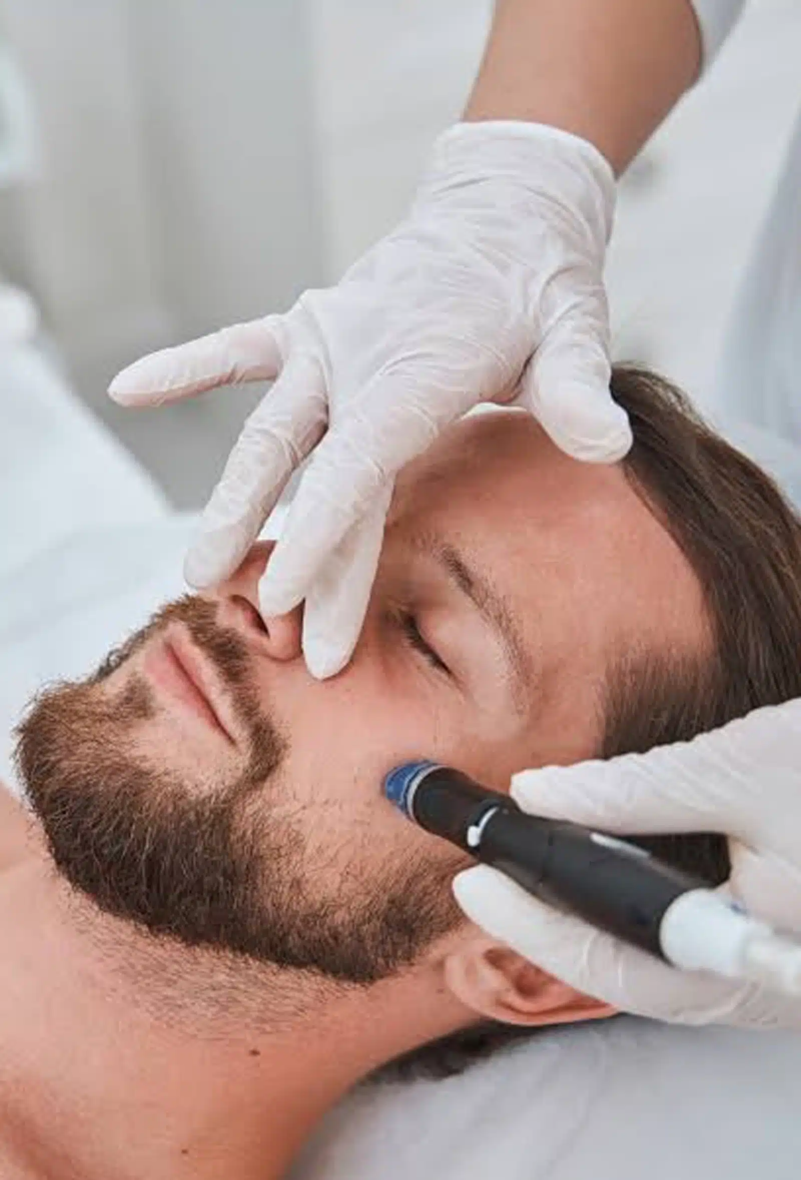 Microneedling and How Does It Trigger Cellular Renewal Micro Needling
