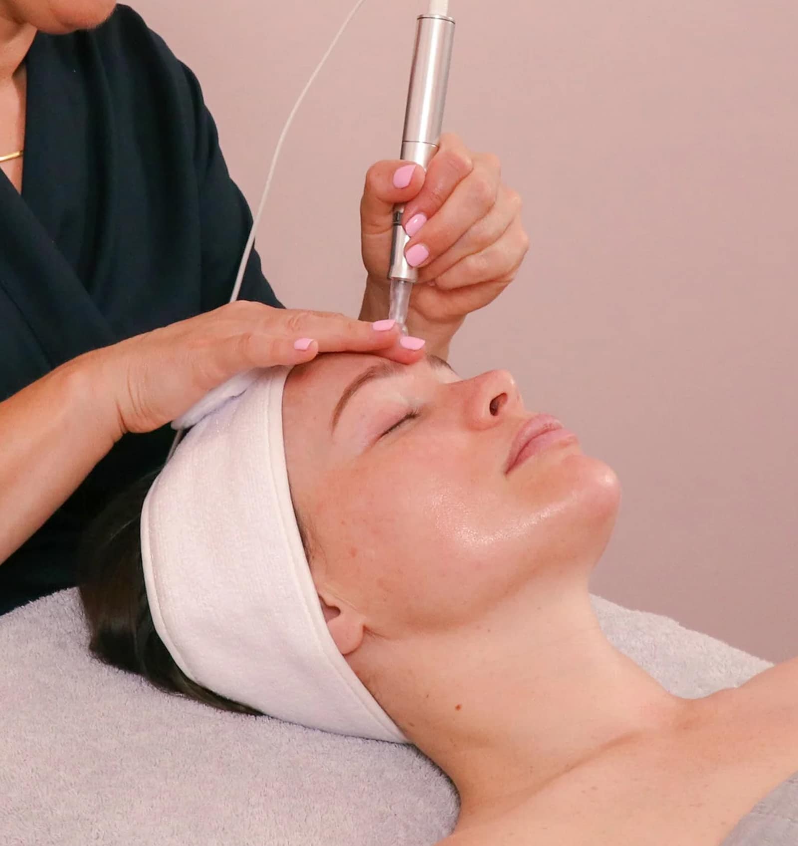 Micro Needling