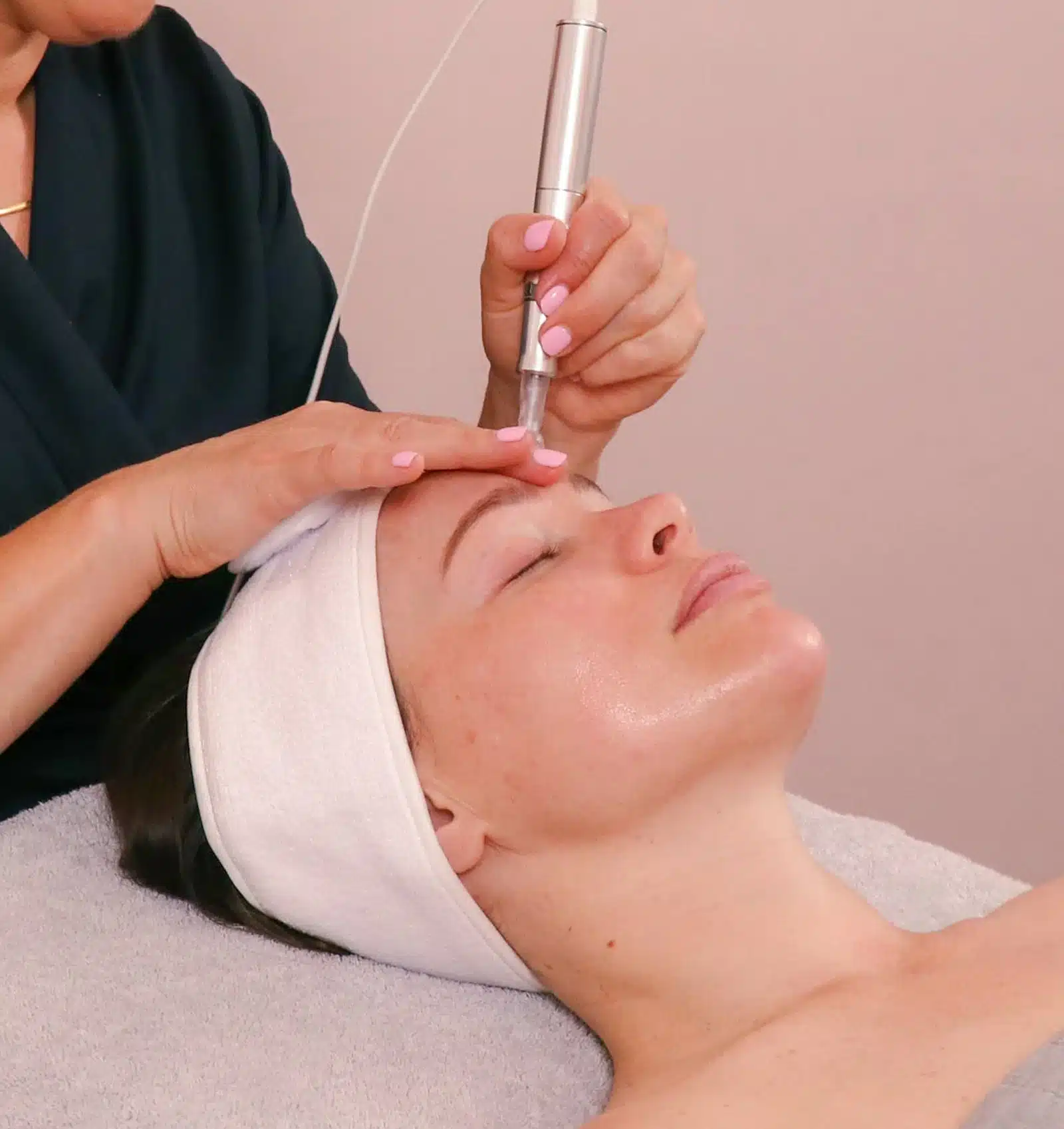 Microneedling with PRP or PRF Micro Needling