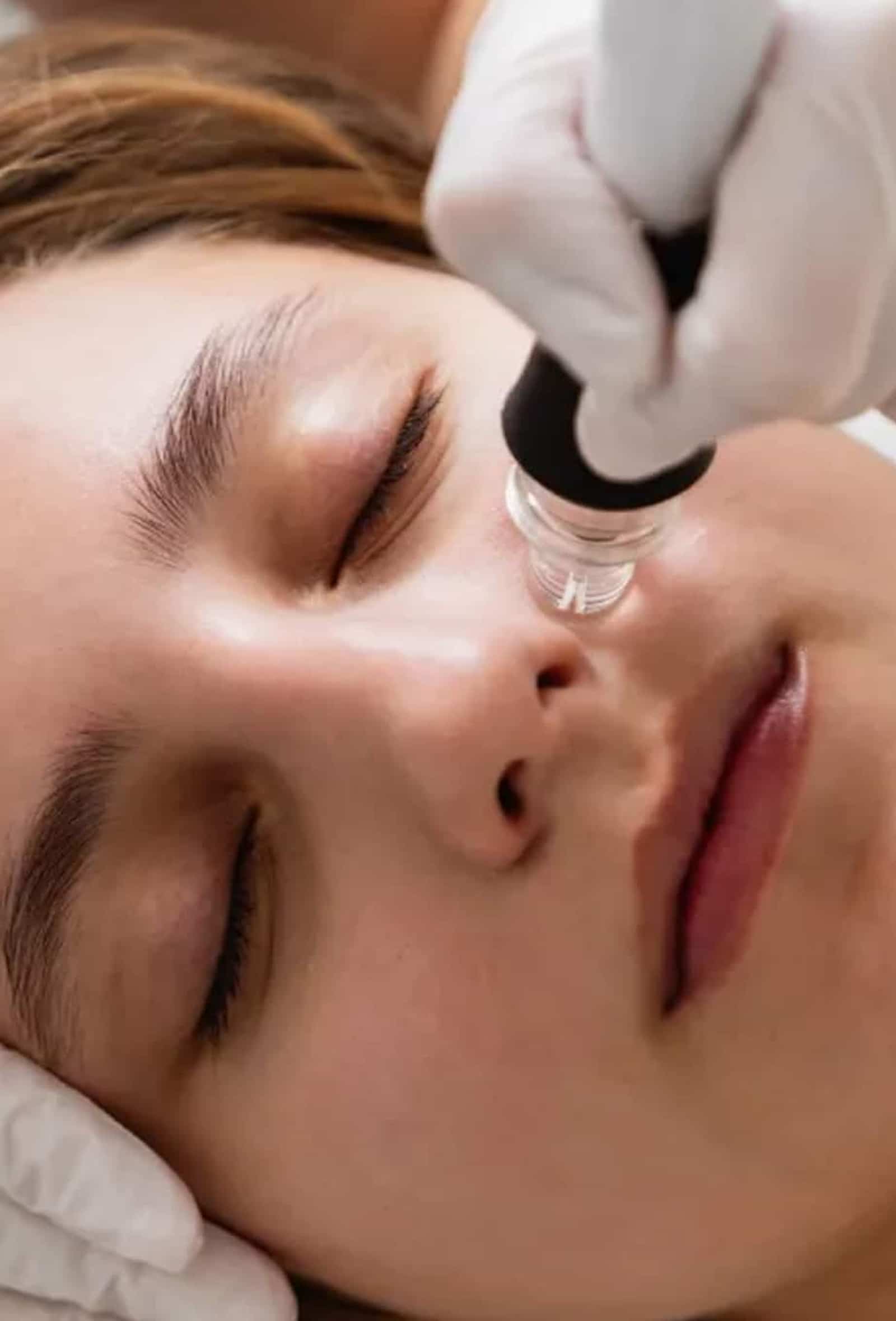 Micro Needling
