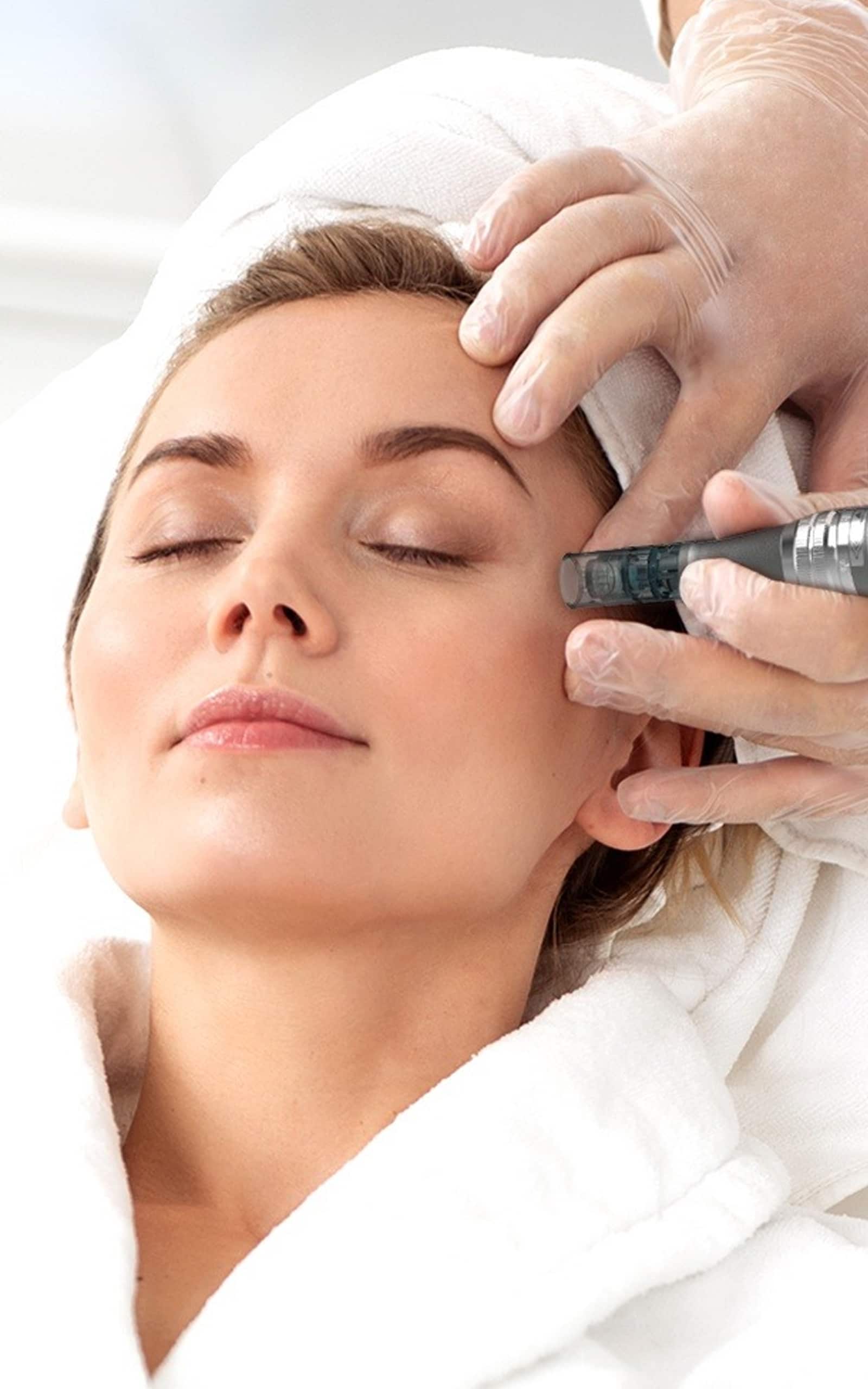 Micro Needling