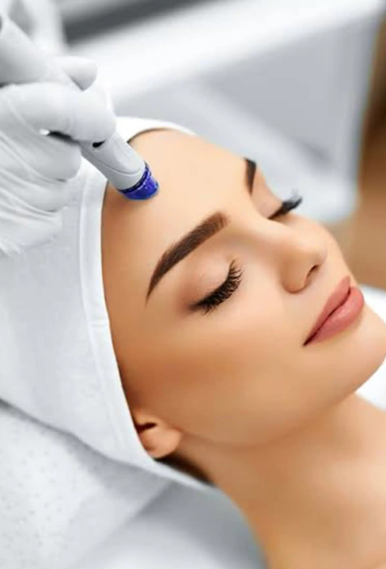 Refined Pores and Improved Texture Micro Needling