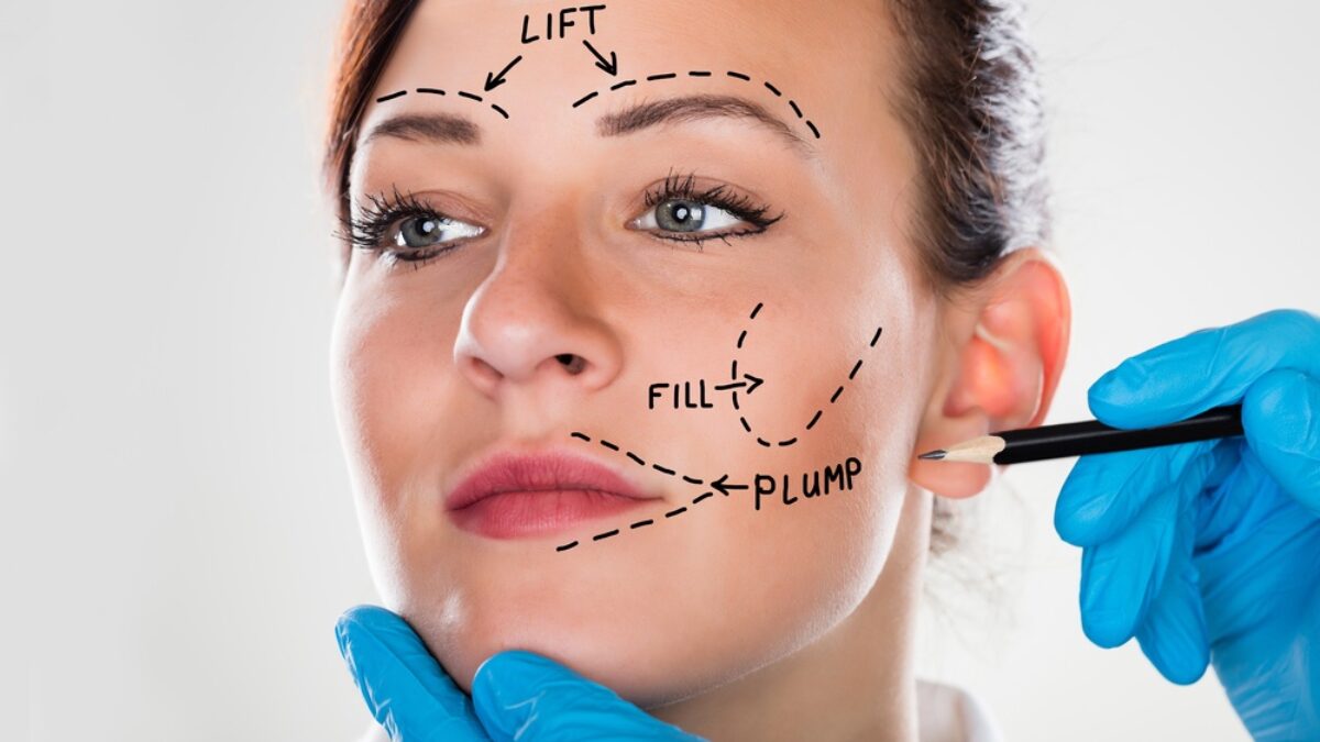 Thread Lift vs. Surgical Facelift