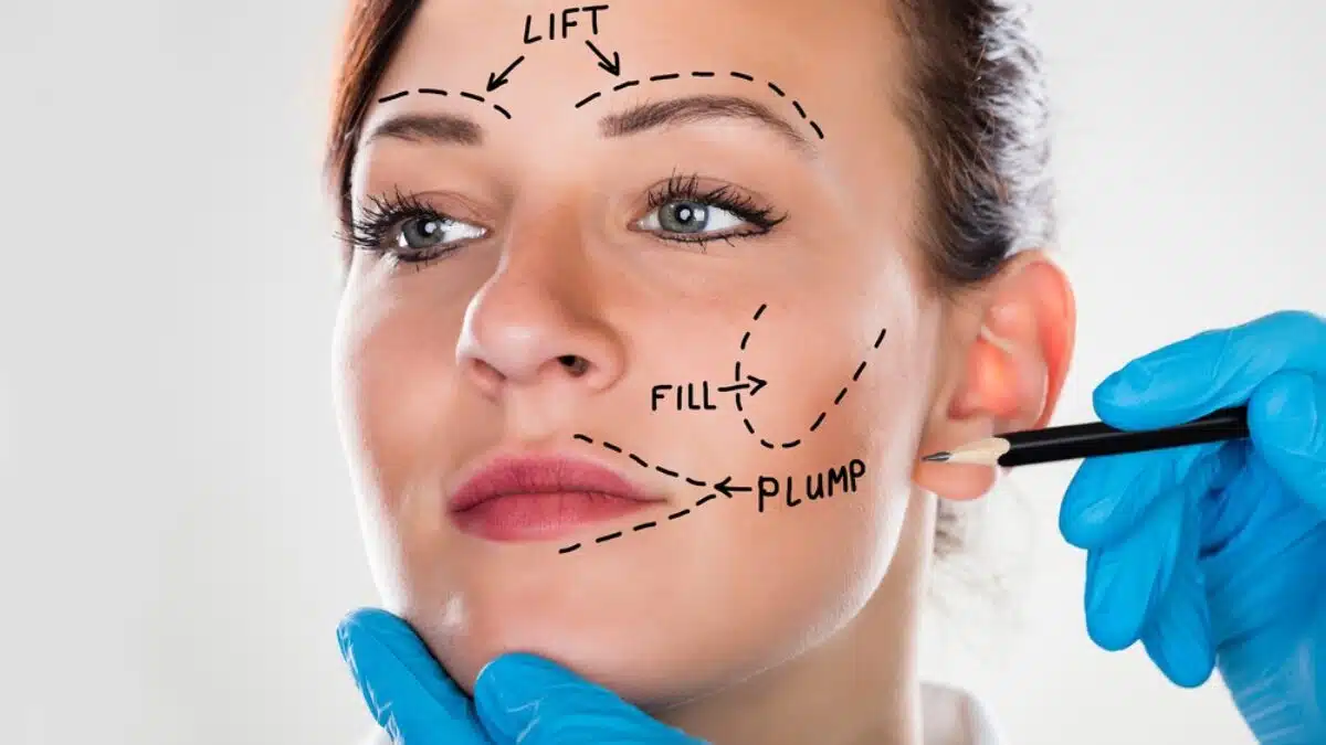 Thread Lift vs. Surgical Facelift