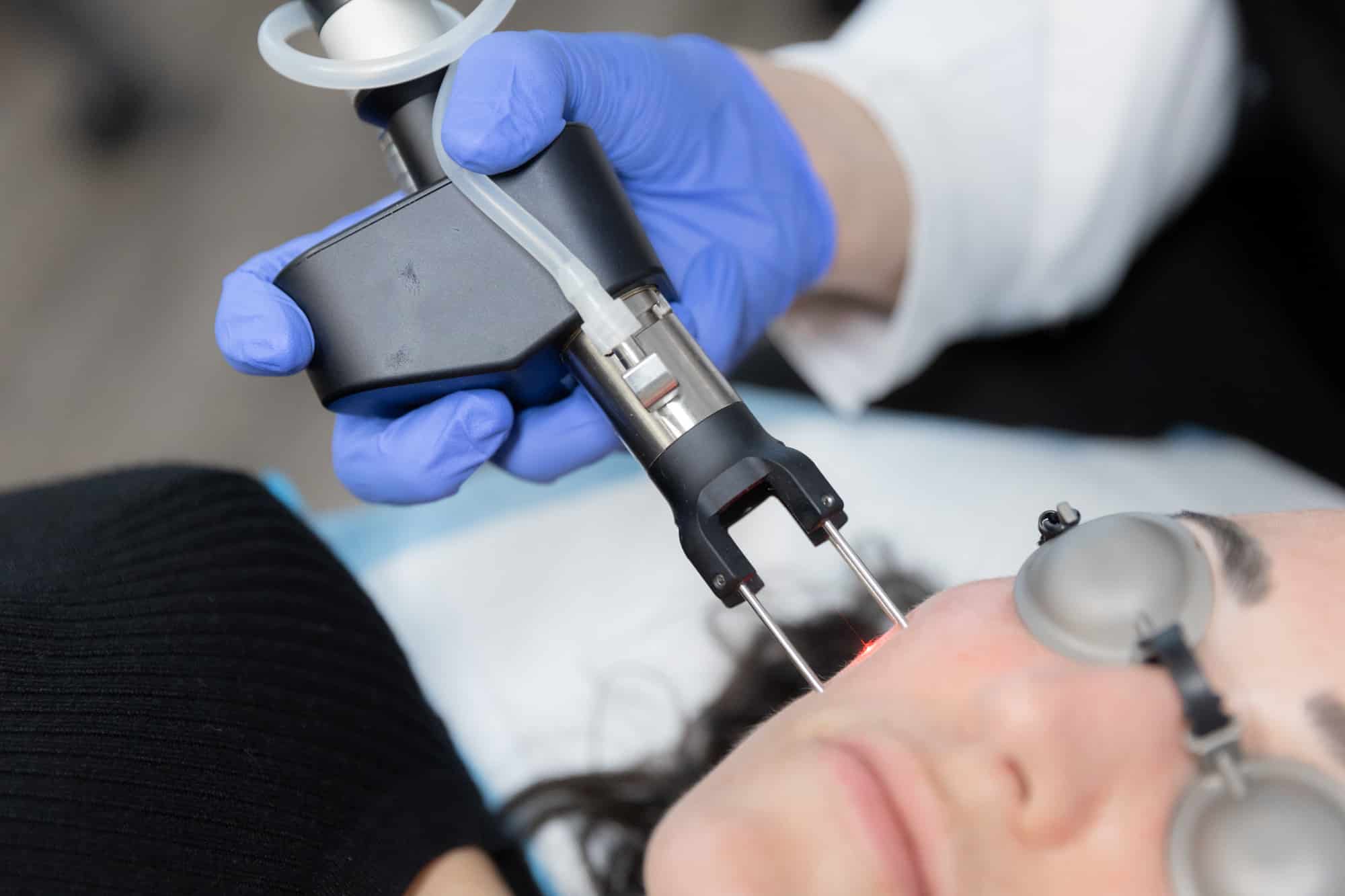 coolmax pro peel vs coolpeel winter park