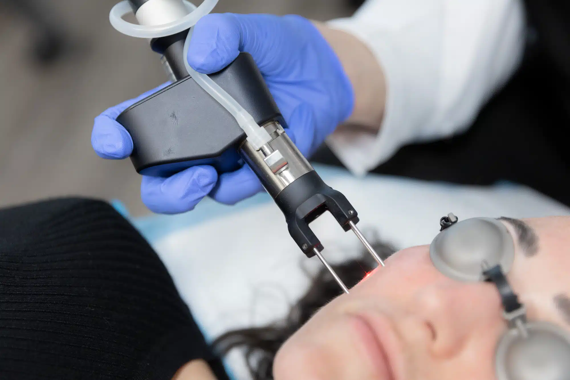 coolmax pro peel vs coolpeel winter park