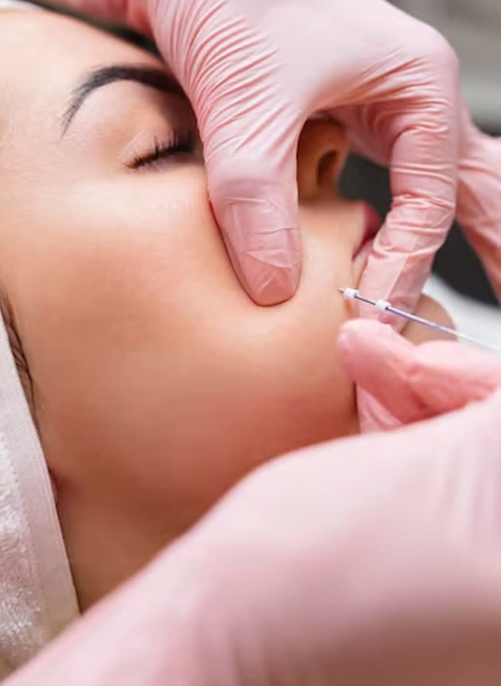 PDO Thread Lift Recovery and Aftercare
