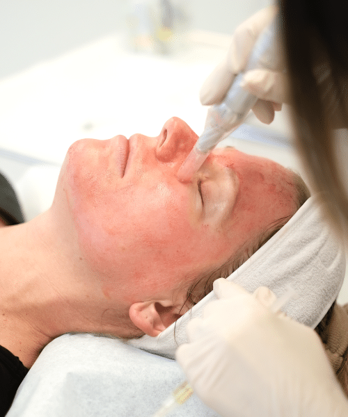 Dermatological Science of Poor Skin Texture