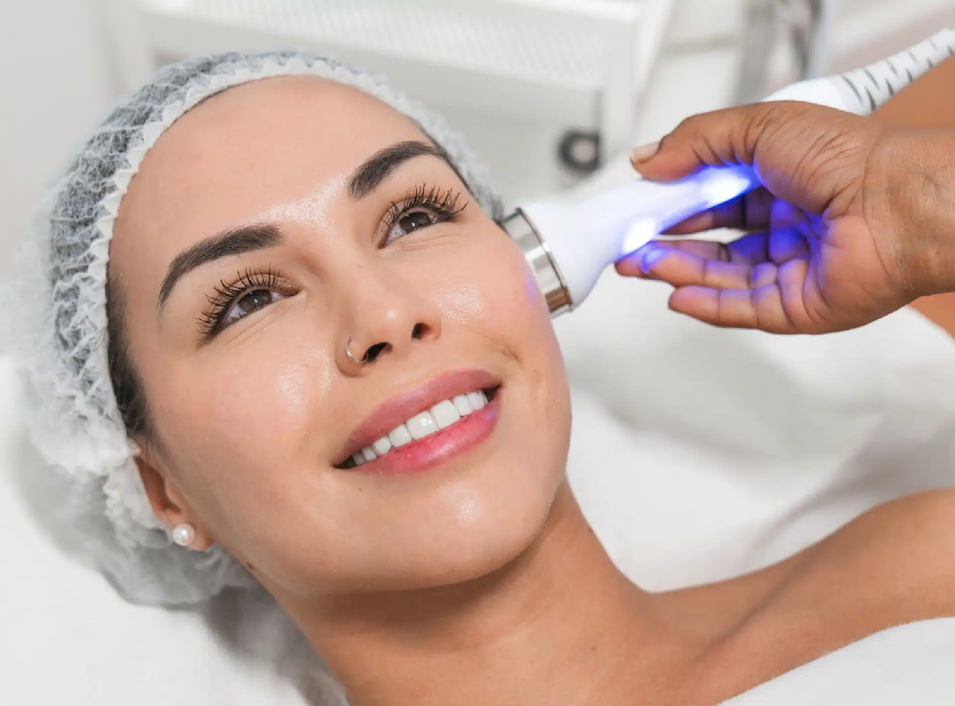 Fractural Skin Resurfacing Orlando