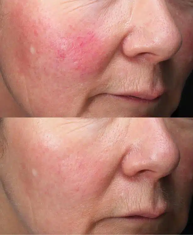 Before & Afters - 750x750 - 3