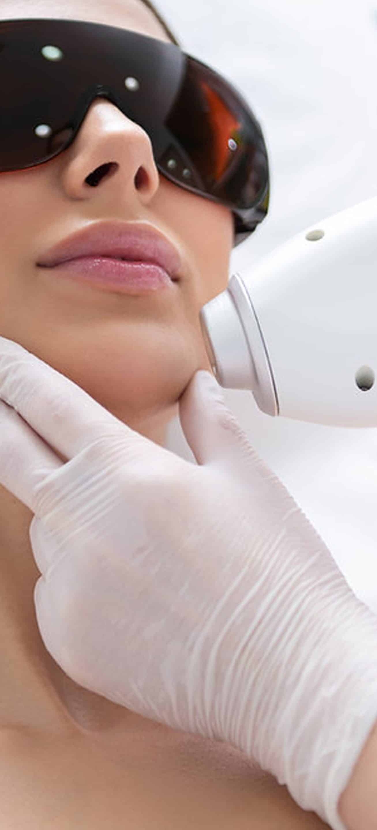 Laser Hair Removal