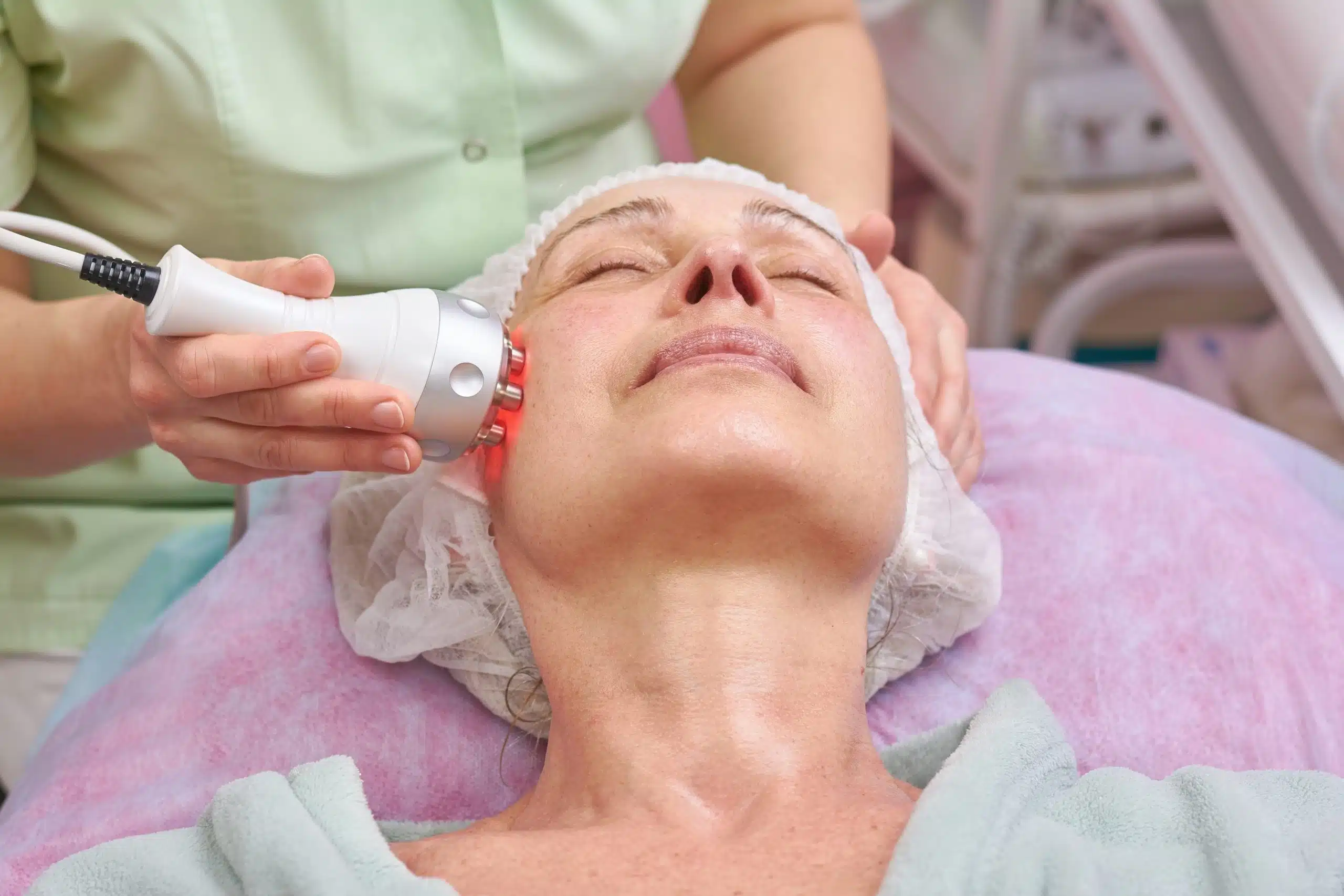 Laser skin resurfacing for texture, fine lines, and acne scars Laser skin resurfacing for texture, fine lines, and acne scars