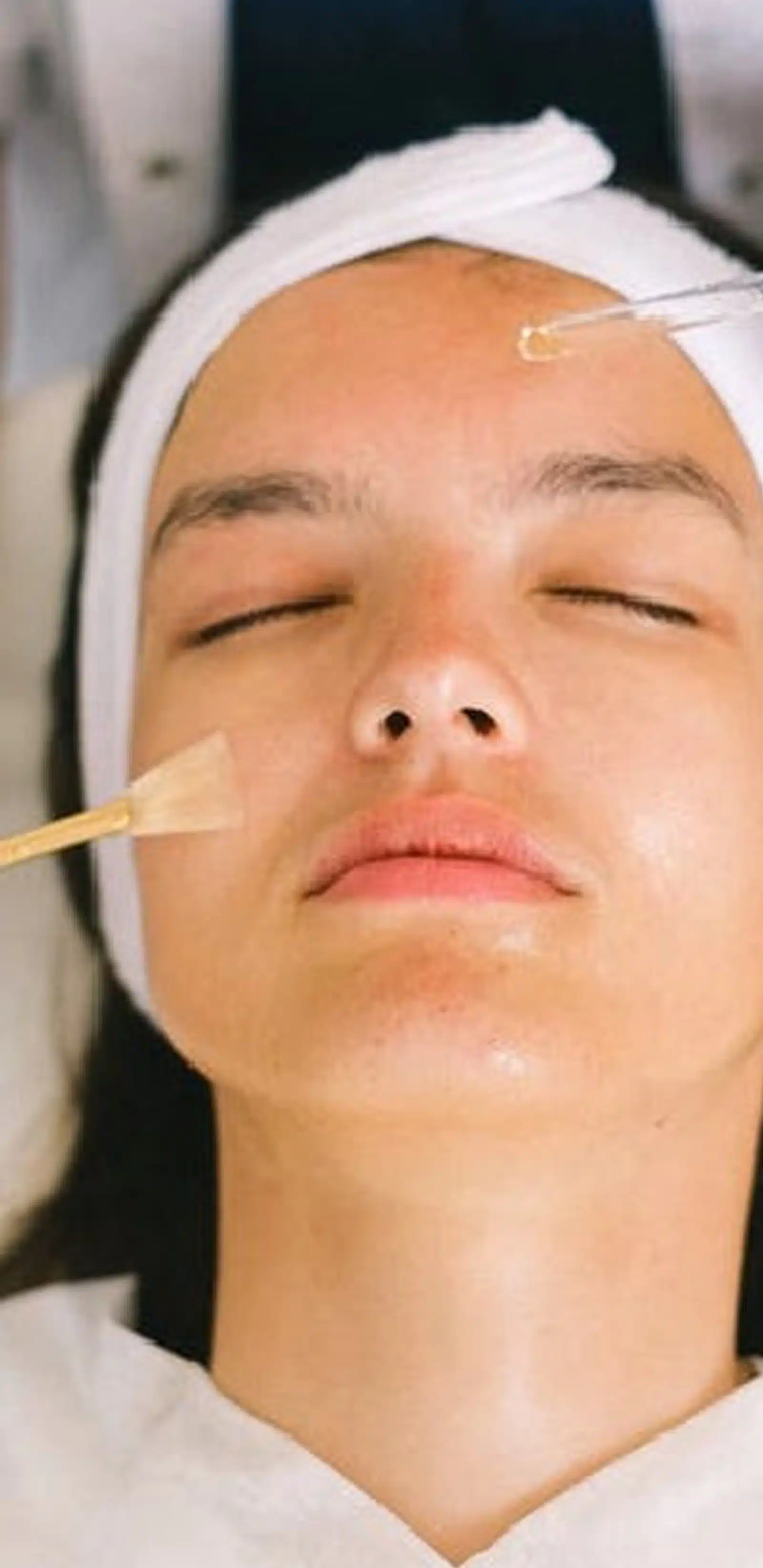 Medical-Grade Chemical Peels