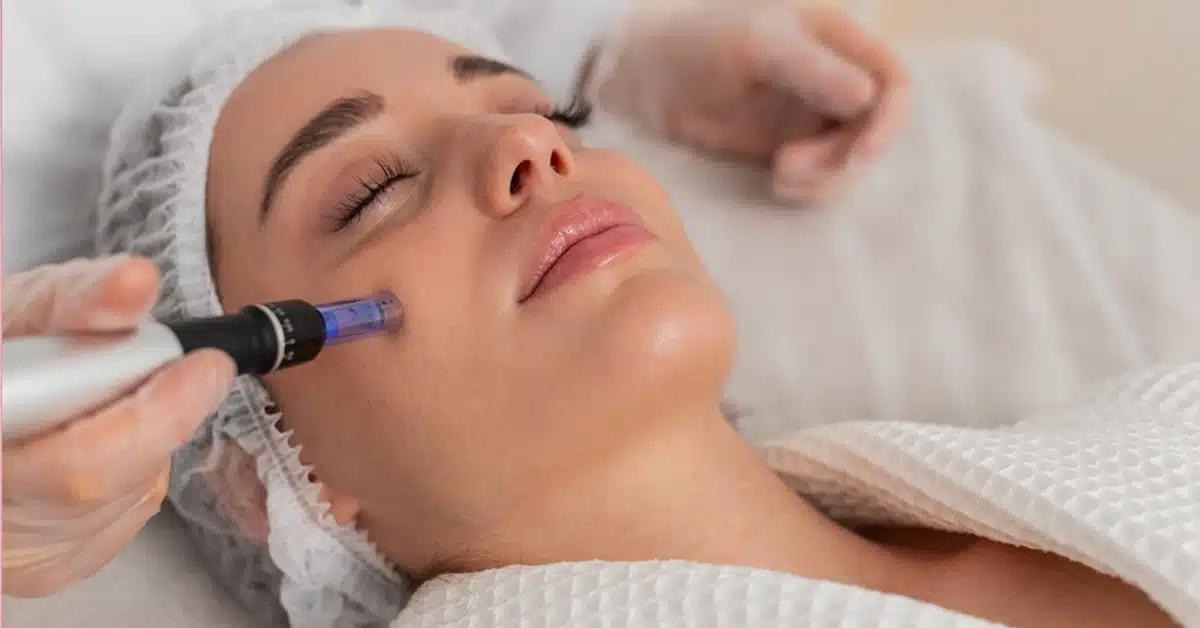 Microneedling & Medical Facials