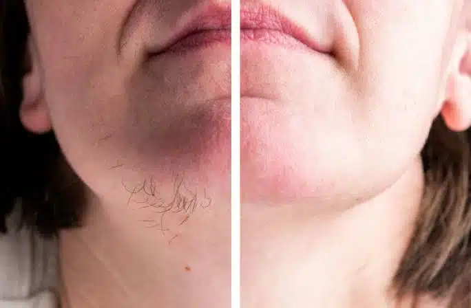 Redefine Your Routine With Smoother, Silky-Looking Skin