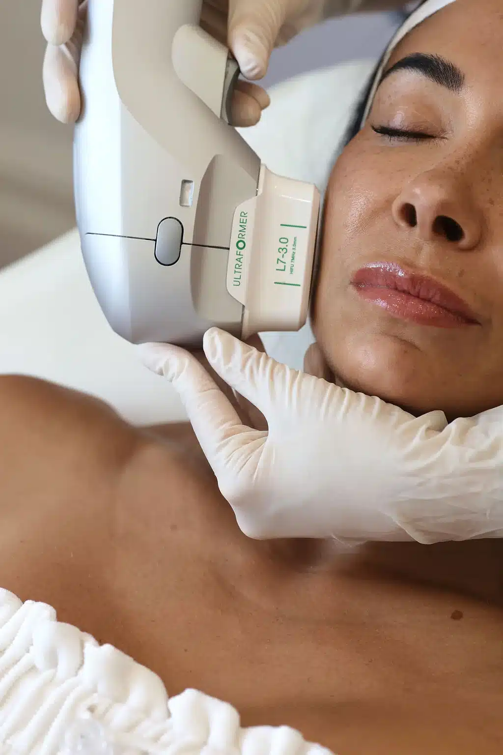 Rejuvenation at Wymore Laser