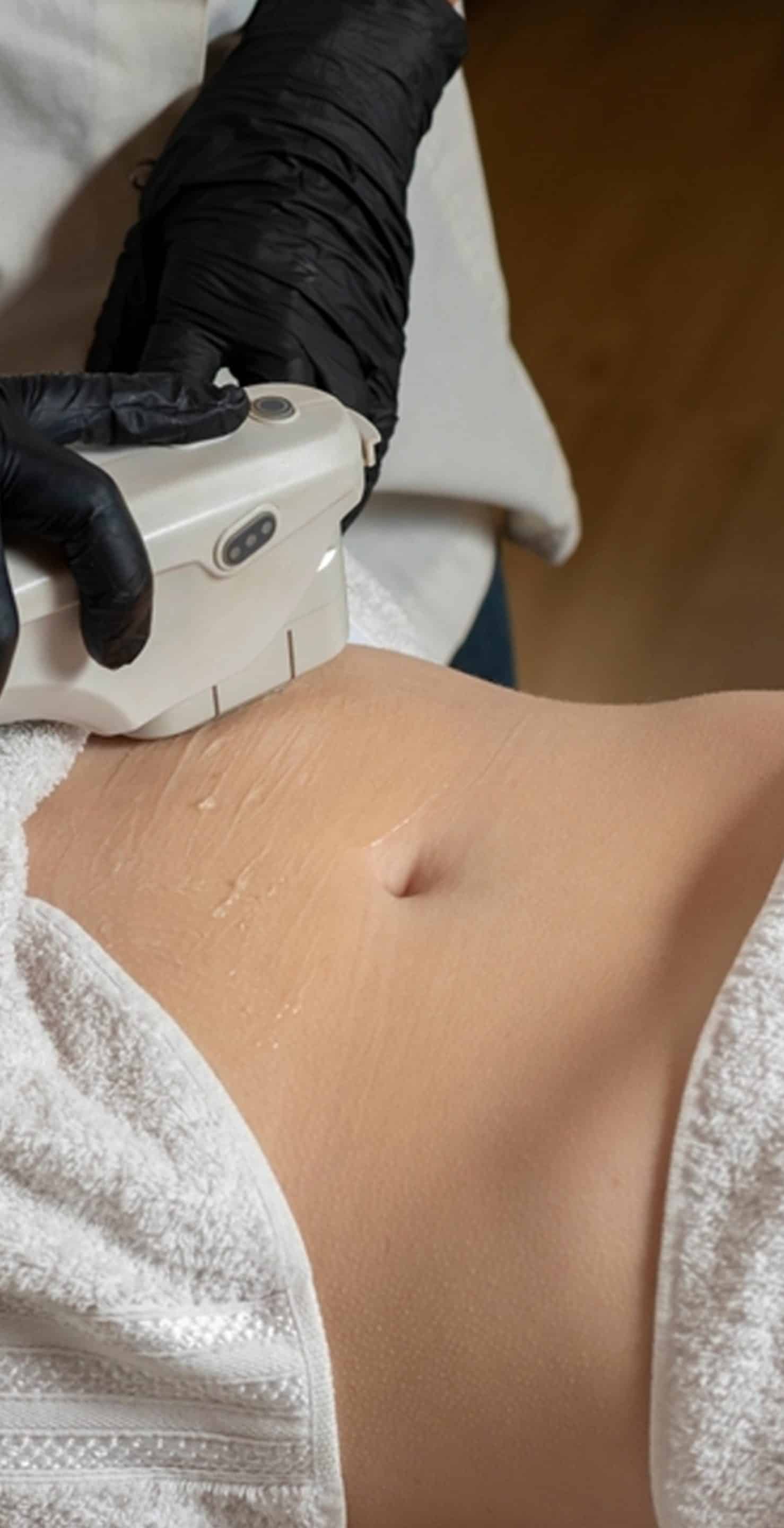 Targeted Approach to Stubborn Fat