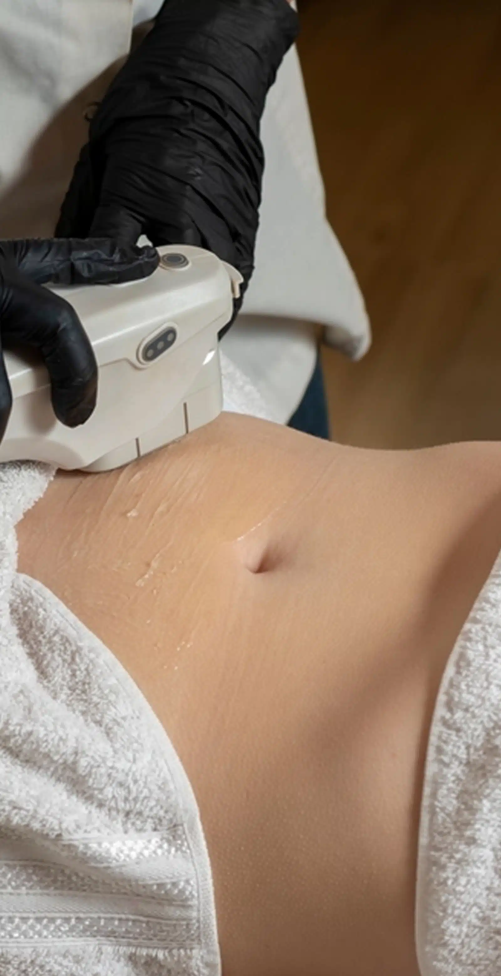 Targeted Approach to Stubborn Fat