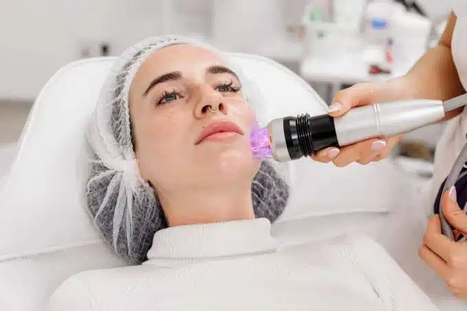Traditional Microneedling