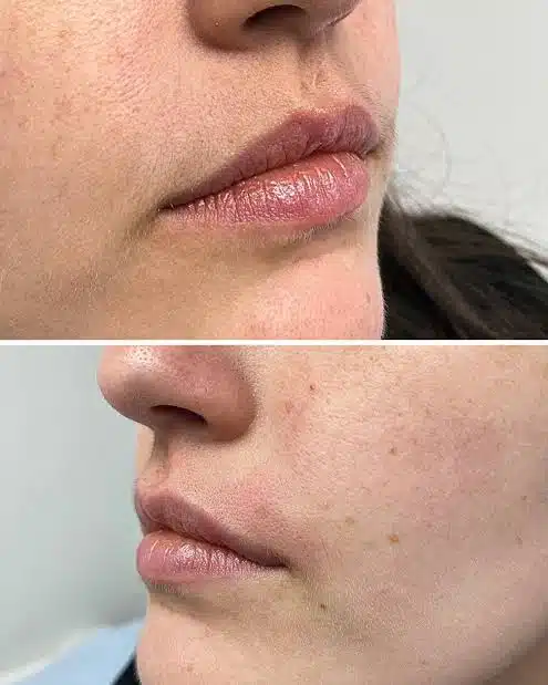 Redefine Your Routine With Smoother, Silky-Looking Skin