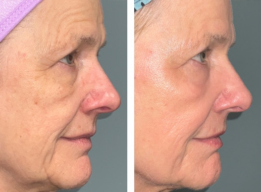 skin texture orlando skin texture orlando